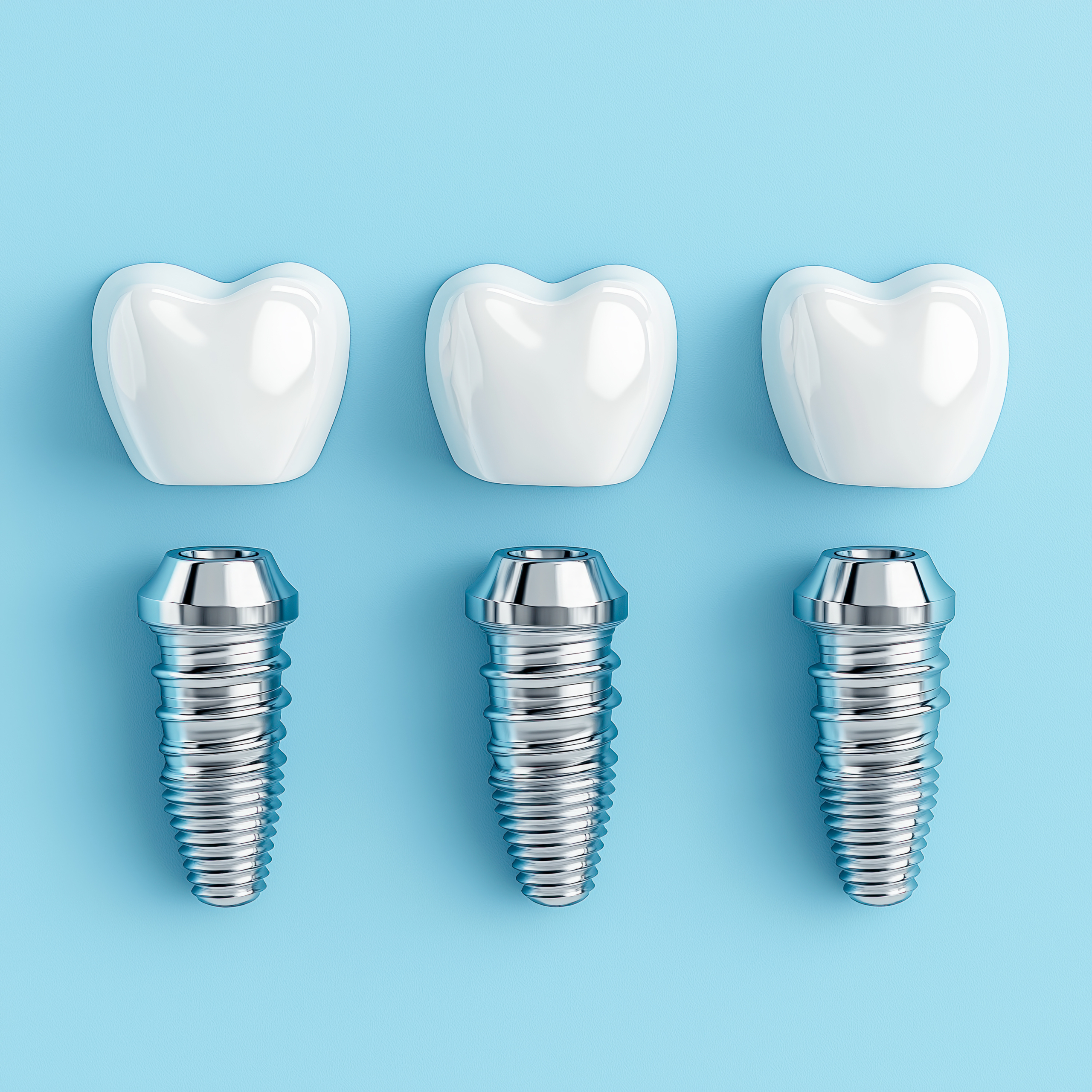 Dental Implants